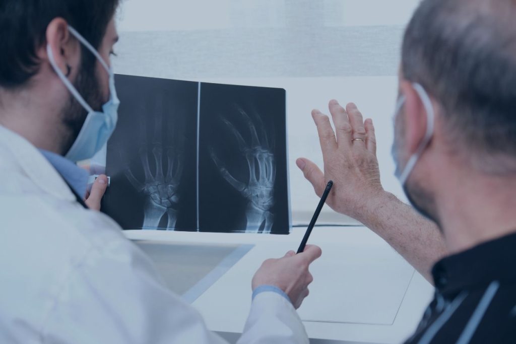 Doctor with hand x-ray of arthritic hands