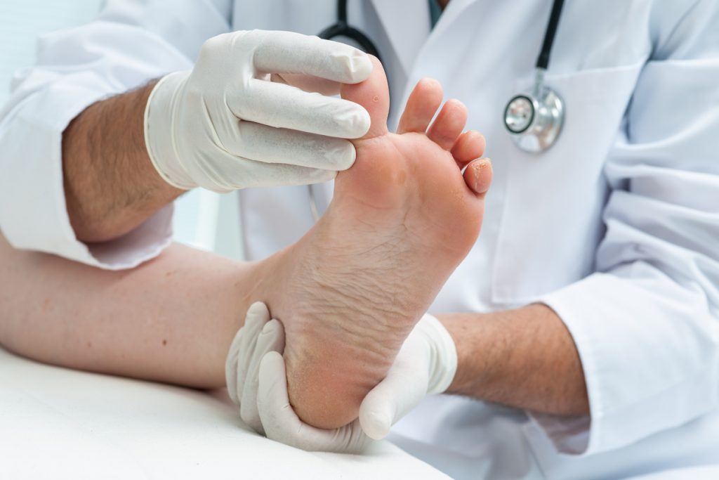 Doctor looking at Athlete's foot