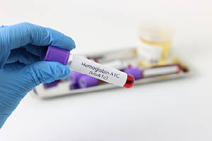 diabetes A1C test blood draw