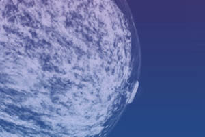 Abstract illustration contrasting light dense tissue and dark fatty tissue, as seen on a breast cancer screening mammogram